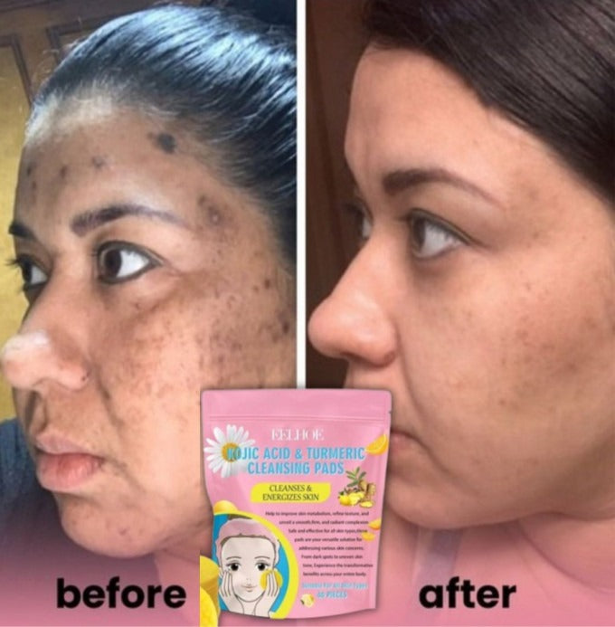 All-in-1 Radiance Pads – For Face & Body Care (40 Pcs) 🔥