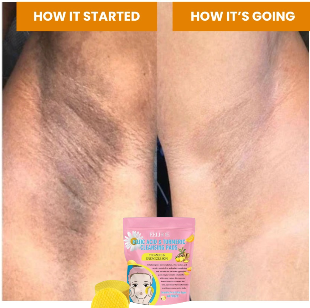 Brightening Turmeric & Kojic Acid Pads