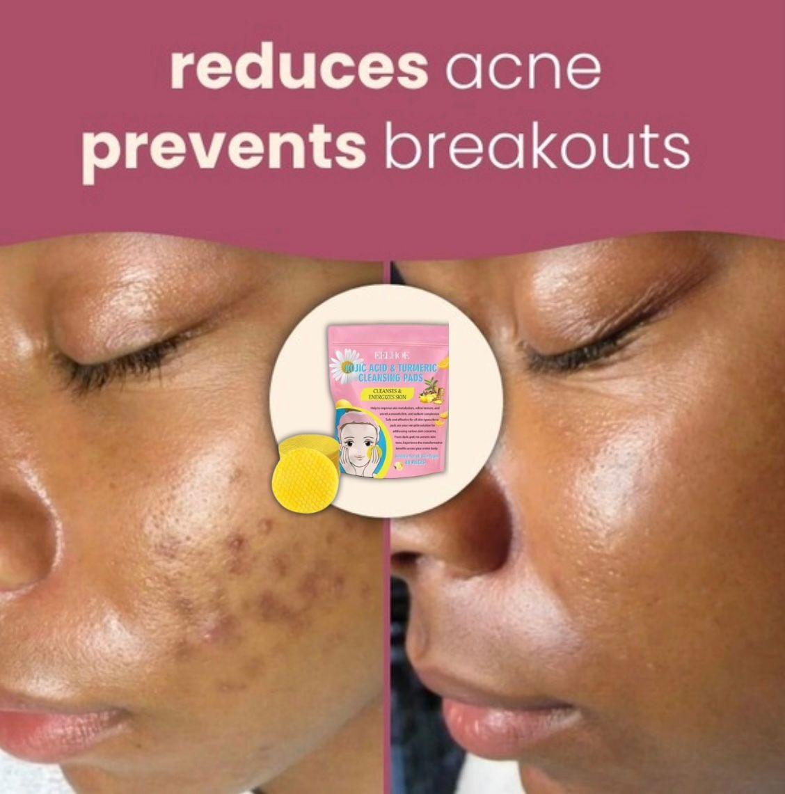All-in-1 Radiance Pads – For Face & Body Care (40 Pcs) 🔥